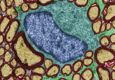 A colorized transmission electron microscope image of an oligodendrocyte (blue) surrounded by cells that it coated in myelin (red outlines).